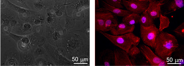 がん細胞に分子が集まった状態の顕微鏡写真