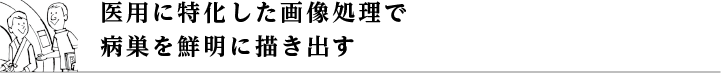 医用に特化した画像処理で病巣を鮮明に描き出す