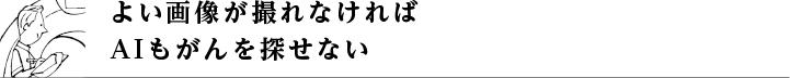 よい画像が撮れなければAIもがんを探せない